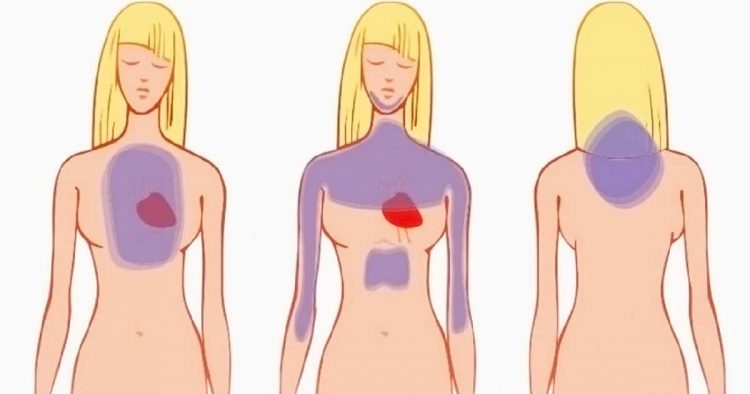 O infarto nas mulheres ocorre de maneira diferente: fique atenta a estes 5 sinais