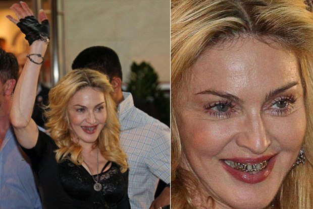 Madonna usando jóias nos dentes