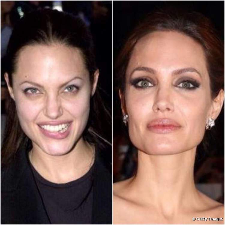 Sobrancelhas da Angelina Jolie - Antes e Depois
