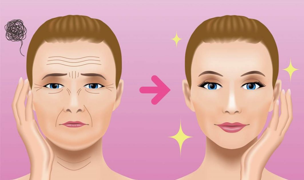 A técnica cirúrgica mais conhecida para o rejuvenescimento facial é a ritidoplastia.